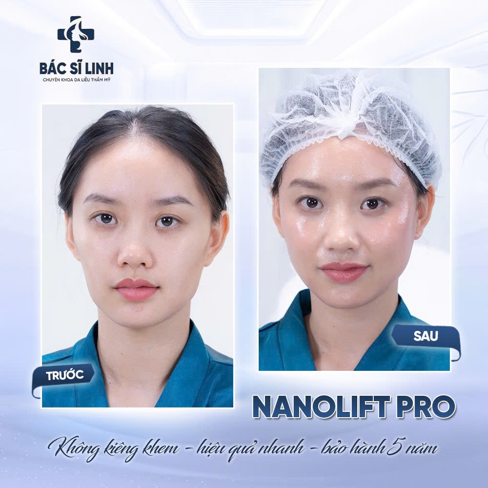 anh-4-1759985604.jpg