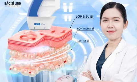 Khi cơ mặt xuống cấp sớm: vì sao nhiều người 30–40 tuổi tìm đến nâng cơ MPT