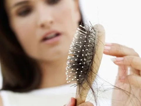 Duy trì phong độ nhờ bí kiếp An Calvitie: chống rụng chữa hói tóc